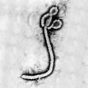 Ebola virus 1.jpg